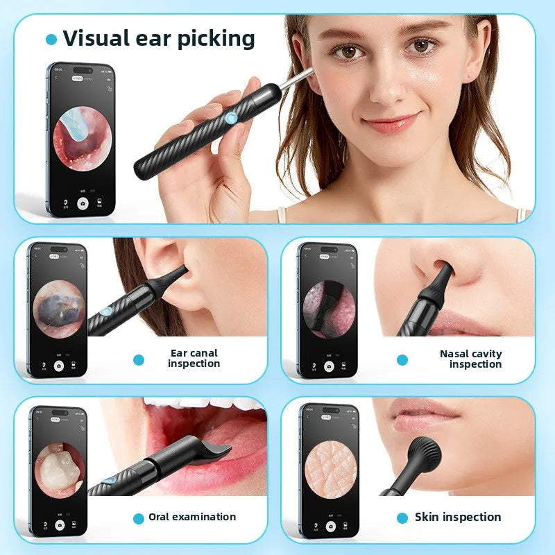 Wireless Ear Wax Removal Tool with 8MP Camera – Smart Visual Ear Cleaner Otoscope with Light – Waterproof Earwax Remover Kit with Silicone Scoops for iPhone & Android