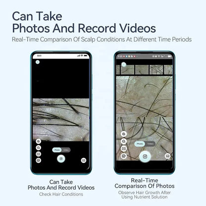 Digital Scalp & Skin Analyzer Machine – 50X-200X HD Dermatoscope Microscope Camera for Hair Density Detection – Smart WiFi Follicle Tester with App for Salons & Home Use