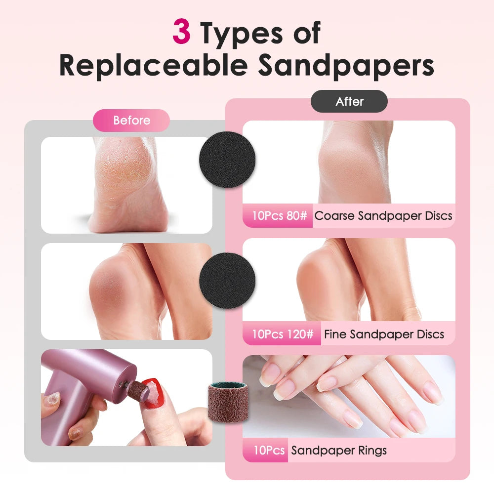 Electric Foot Callus Remover Kit – 3-in-1 Rechargeable Electronic Foot File & Grinder – Portable Professional Pedicure Tools for Dead Skin, Cracked Heels & Calluses (Pink)