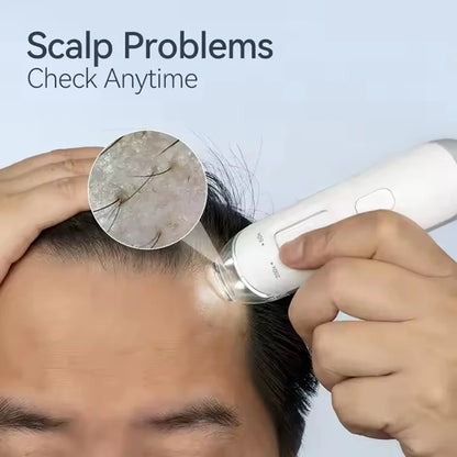 Digital Scalp & Skin Analyzer Machine – 50X-200X HD Dermatoscope Microscope Camera for Hair Density Detection – Smart WiFi Follicle Tester with App for Salons & Home Use